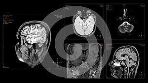 Head MRI scan from different angles