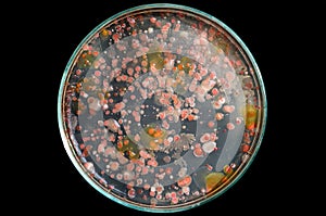 Top view soil microorganisms Nutrient agar in plate on black background