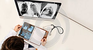 Top view of young man radiologist doctor analises x ray and computer tomography film and make a medical xray description in