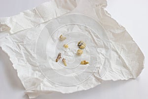 Torn out damaged tooth roots and used cermet dental crowns lie on white napkin