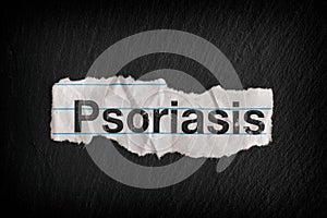 Torn piece of paper with the word Psoriasis