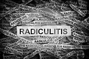 Torn pieces of paper with the word Radiculitis