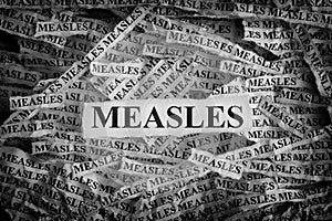 Torn pieces of paper with the words Measles