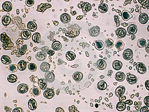 Toxocara canis embryonated egg with larva