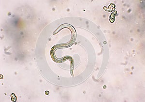 Toxocara canis second stage larvae hatch from eggs