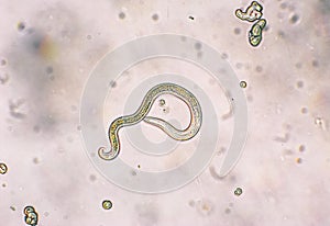 Toxocara canis second stage larvae hatch from eggs