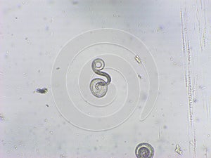 Toxocara canis second stage larvae hatch from eggs