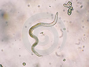 Toxocara canis second stage larvae hatch from eggs