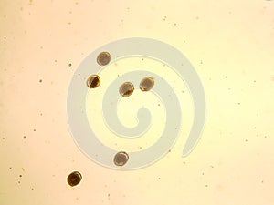 Toxocara cati egg under the microscope