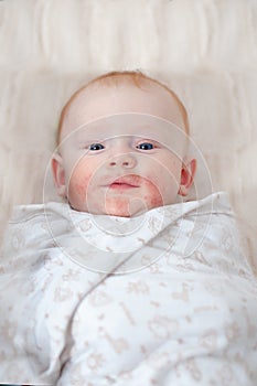 Traces of an allergy on the baby`s cheeks