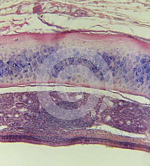 Trachea,mammalian