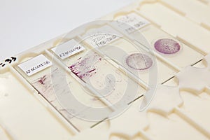 Traditional and liquid based cytology microscope slides for pap smear test. Cervical cancer concept. Medical concept