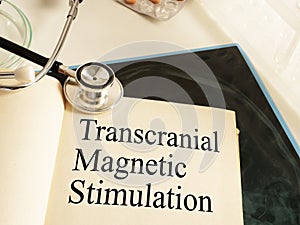 Transcranial Magnetic Stimulation TMS is shown on the photo using the text photo