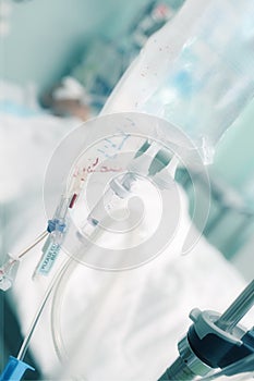 Transfusion of blood products and infusion therapy in the treatment of a seriously ill patient photo