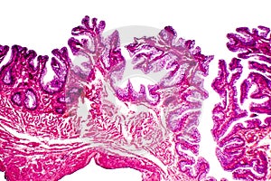 Transitional epithelium tissue