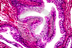 Transitional epithelium tissue