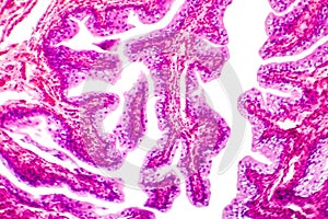 Transitional epithelium tissue