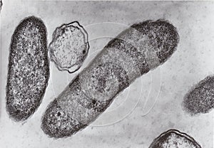 Transmission electron microscope photo of vibrio bacteria x76000