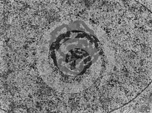 Nucleolus, TEM photo