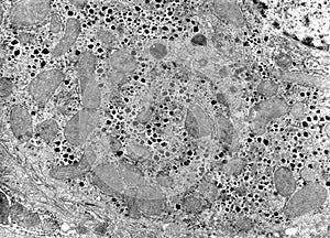 Cytoplasm. Cell organelles, TEM photo