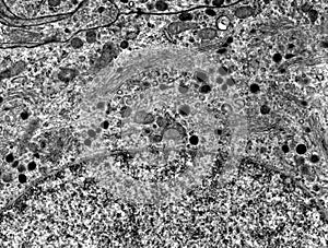 Golgi complex. TEM photo