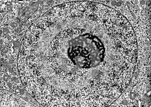 Cell nucleus. TEM