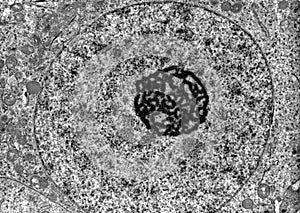 Cell nucleus. TEM photo