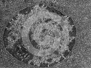 Nucleus and nucleolus, TEM