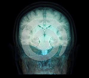 Transparent image of the Skull  with  Brain for medical background concept