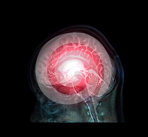 Transparent image of the Skull  with  Brain for medical background concept