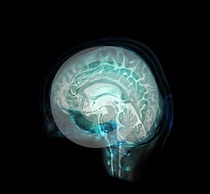 Transparent image of the Skull  with  Brain for medical background concept