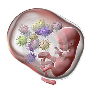 Transplacental transmission of Cytomegalovirus to human embryo