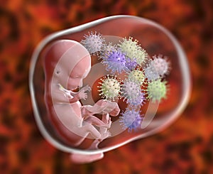 Transplacental transmission of Cytomegalovirus to human embryo