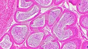 Transversal section of testis shown under microscope and magnified in 100 times