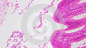 Transversal section of testis shown under microscope and magnified in 400 times