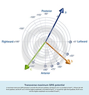 Transverse maximum QRS potential