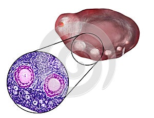 Transverse section of an ovary