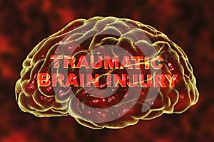 Traumatic brain injury