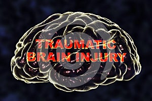 Traumatic brain injury photo