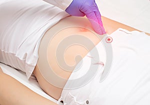 A traumatologist doctor examines the lower abdomen of a girl who has a blunt abdominal injury.