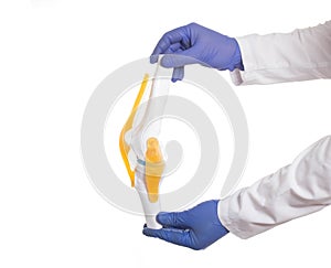 Traumatologist doctor holds a knee joint model on a white background. Knee and Meniscus Injury Concept, treatment photo