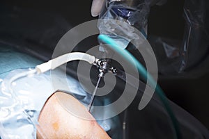 Traumatology orthopedic surgery knee arthroscopy drip