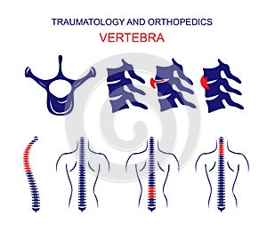 TRAUMATOLOGY AND ORTHOPEDICS. The SPINE. VERTEBRA. photo