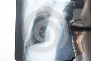 Traumatology surgeon roentgenogram X-ray photo