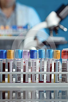 Tray with tubes with blood samples