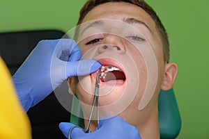 Treatment of abnormal teeth occlusion in adolescents.
