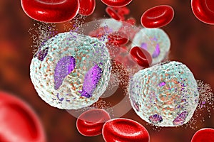 Treatment of acute lymphoblastic leukemia