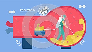 Treatment and clean alveoli. Pneumonia is infection that inflames air sacs in one or both lungs. This symptom is caused by