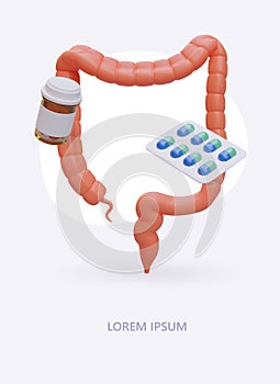 Treatment of colon diseases. Ulcerative colitis, diverticulitis, constipation photo