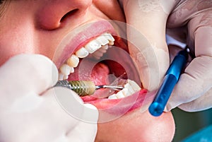 Trattamento sul il dentista 